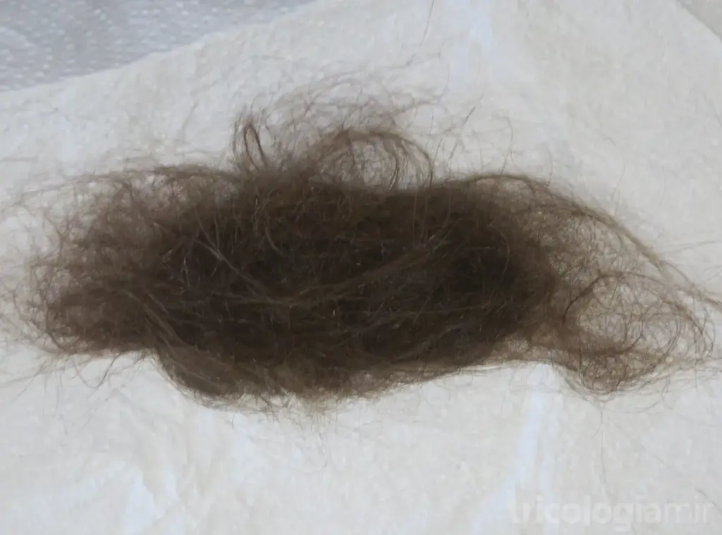 Caída notable de cabello recogida durante la ducha