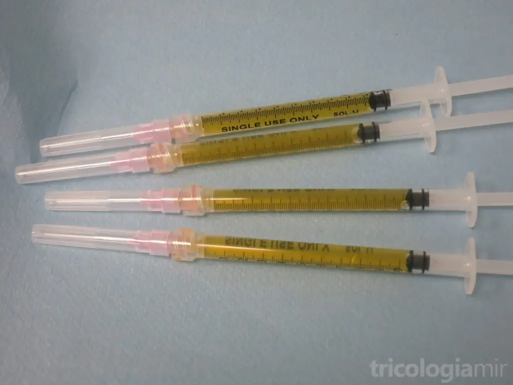 La centrifugadora separa el plasma de la sangre, obteniéndose 4ml de plasma rico en plaquetas